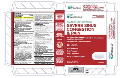 Severe Sinus Congestion And Pain (Severe Sinus Congestion And Pain)